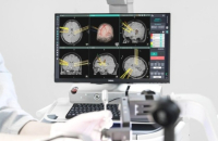 Allianz-backed Koh Young’s brain surgery robot set for US debut by end-August